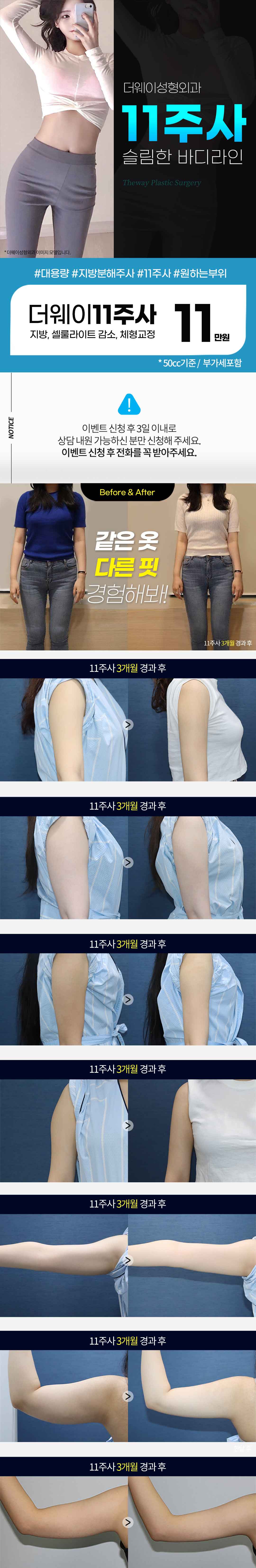 11주사 이벤트 랜딩 이미지 1