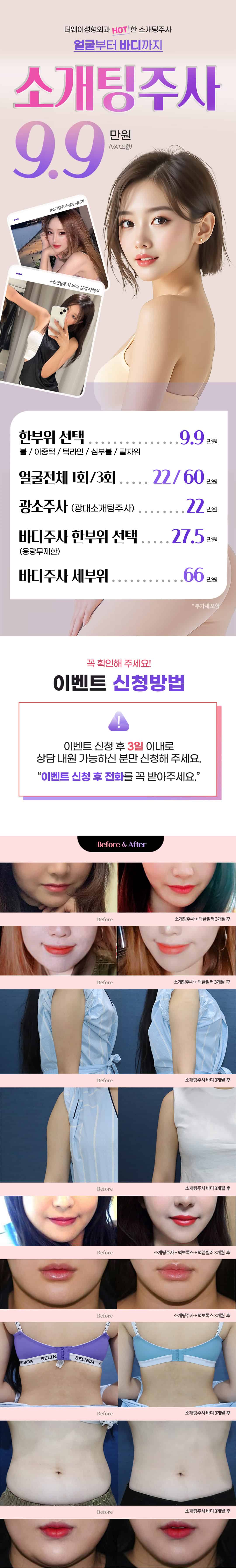 소개팅주사 이벤트 랜딩 이미지 1