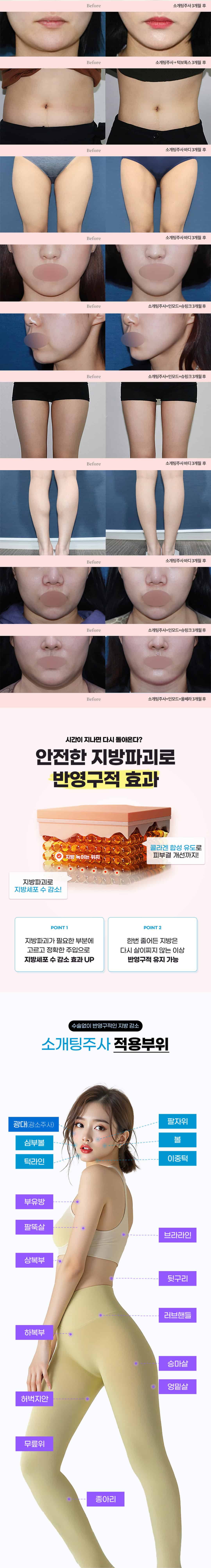 소개팅주사 이벤트 랜딩 이미지 2