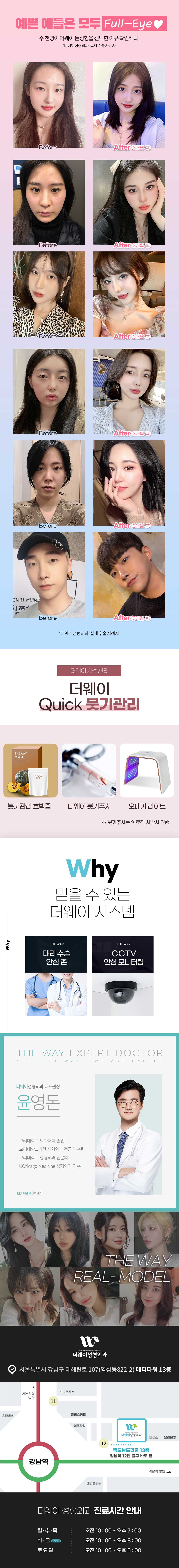 눈성형 이벤트 랜딩 이미지 3